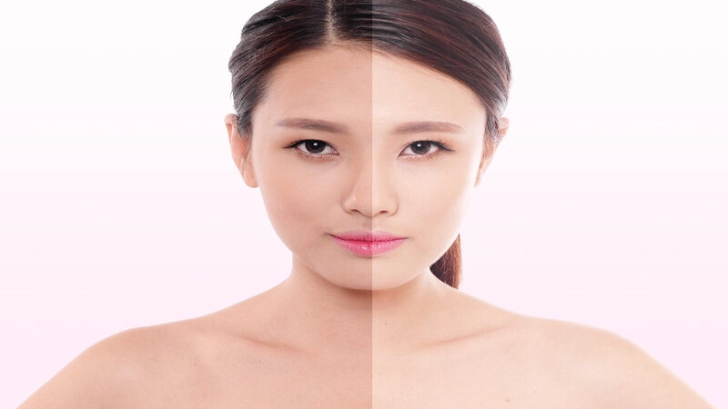 Kinh nghiệm làm trắng da đen bẩm sinh