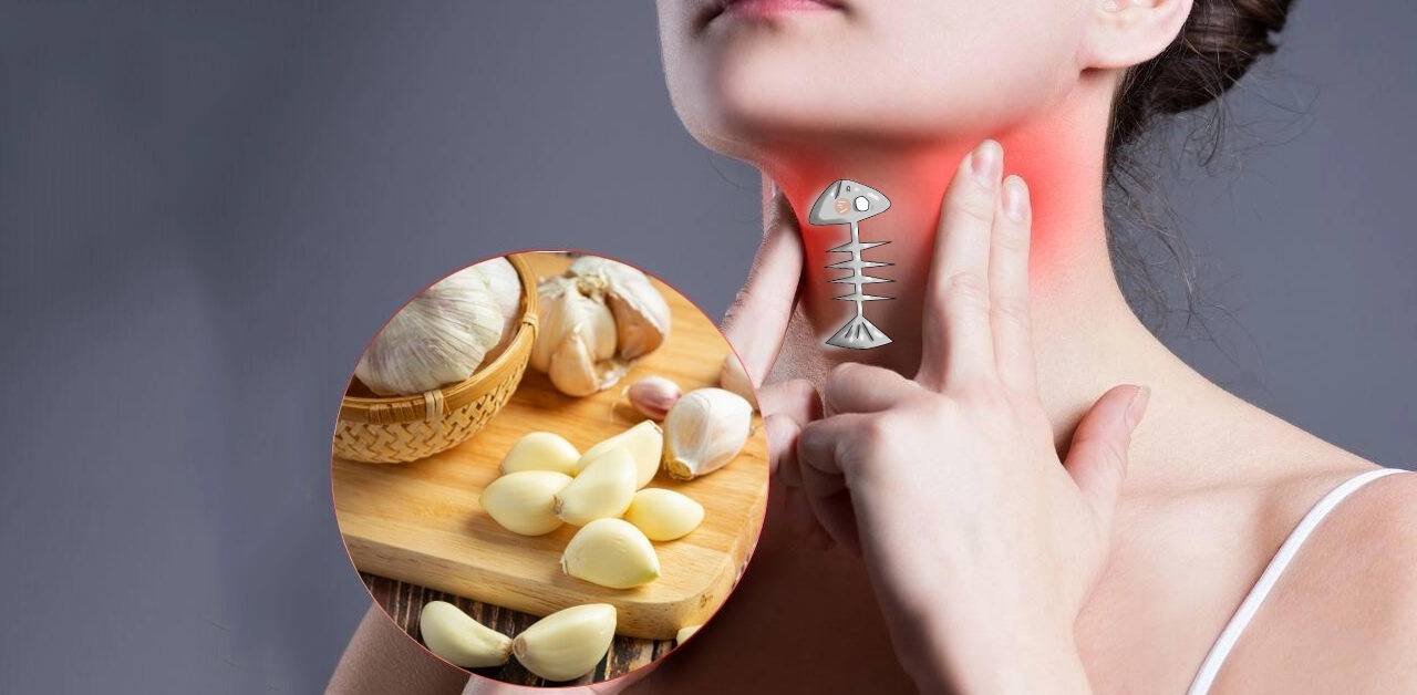 mẹo chữa hóc xương cá