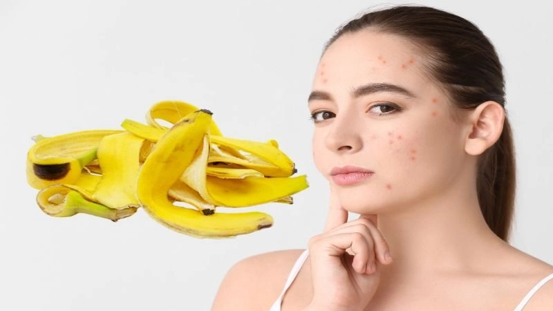 mẹo chữa mụn cóc dân gian