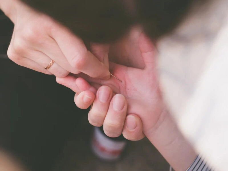 Mẹo lấy dằm ra khỏi tay