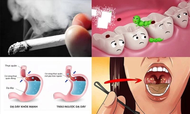 Mẹo vặt chữa hôi miệng